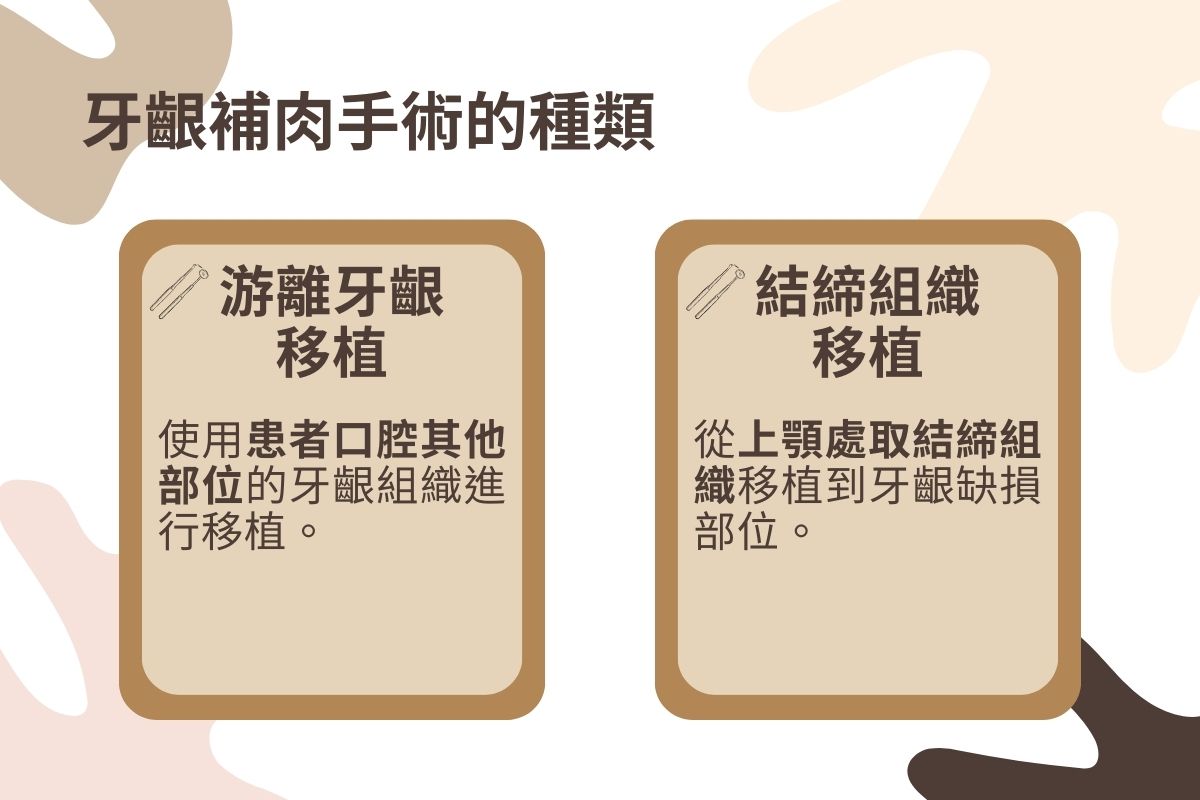 牙齦補肉手術種類有分為游離牙齦移植及結締組織移植2種